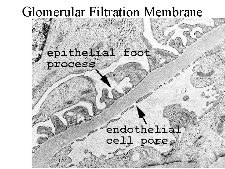 Glomerular Filtration Membrane 