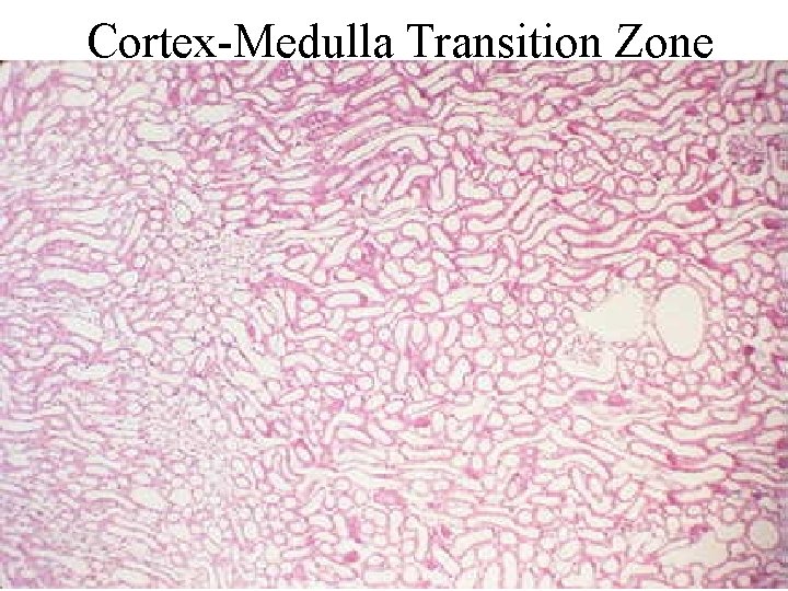 Cortex-Medulla Transition Zone 