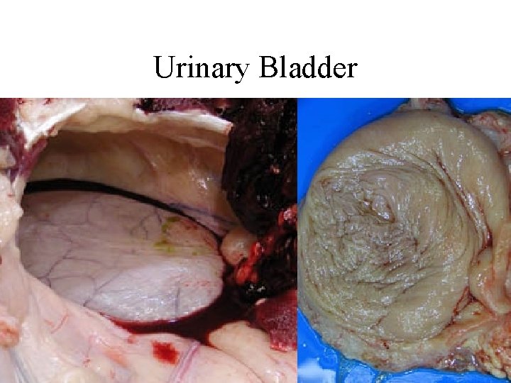 Urinary Bladder 