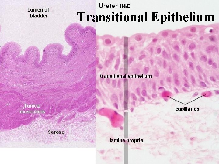 Transitional Epithelium 