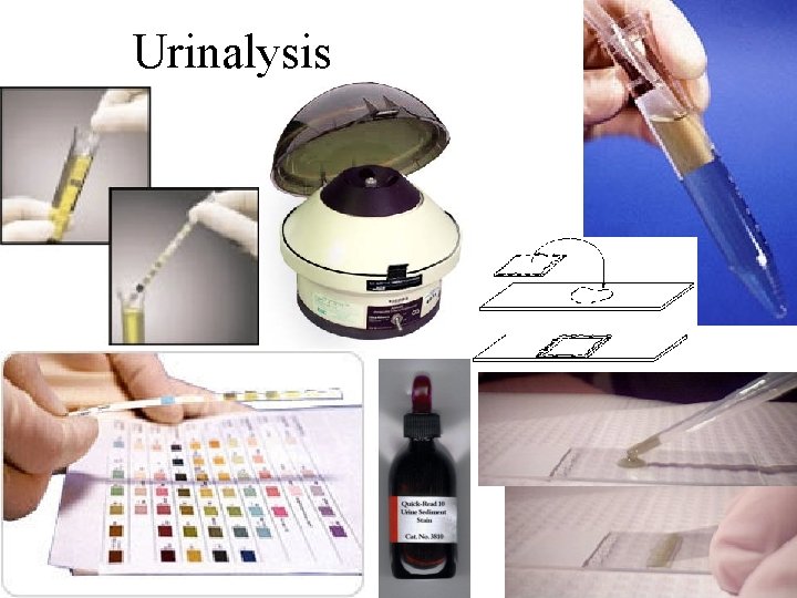 Urinalysis 