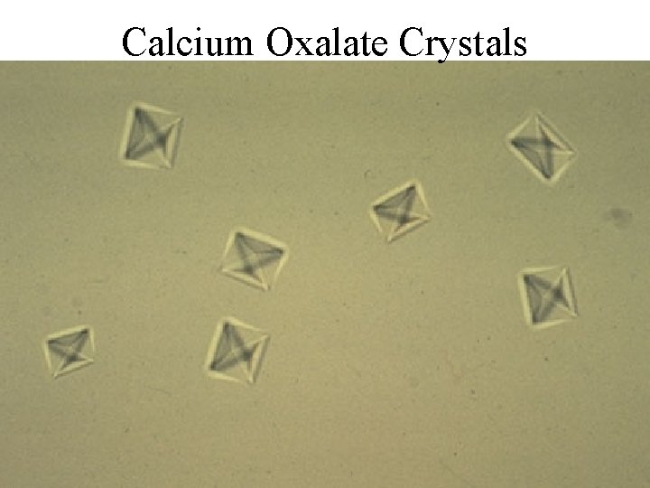 Calcium Oxalate Crystals 