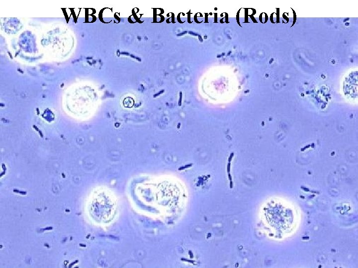 WBCs & Bacteria (Rods) 
