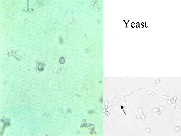 Yeast 