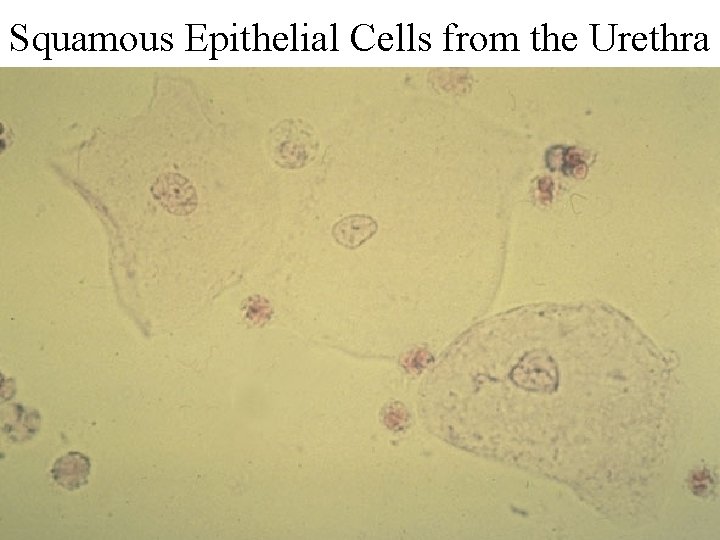 Squamous Epithelial Cells from the Urethra 