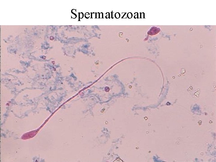 Spermatozoan 