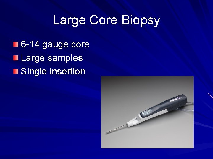 Large Core Biopsy 6 -14 gauge core Large samples Single insertion 