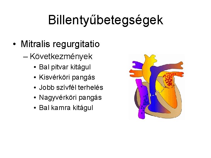 Billentyűbetegségek • Mitralis regurgitatio – Következmények • • • Bal pitvar kitágul Kisvérköri pangás