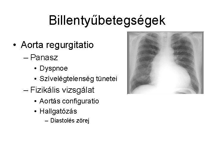 Billentyűbetegségek • Aorta regurgitatio – Panasz • Dyspnoe • Szívelégtelenség tünetei – Fizikális vizsgálat