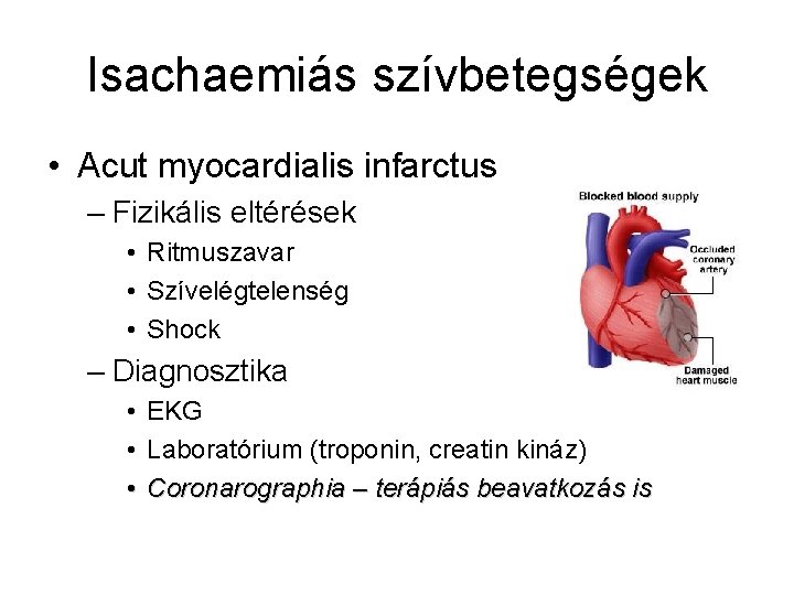 Isachaemiás szívbetegségek • Acut myocardialis infarctus – Fizikális eltérések • Ritmuszavar • Szívelégtelenség •