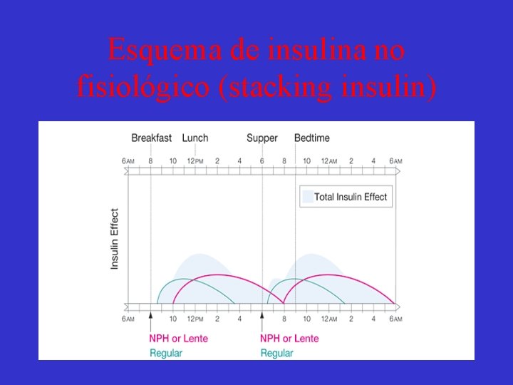 Esquema de insulina no fisiológico (stacking insulin) 