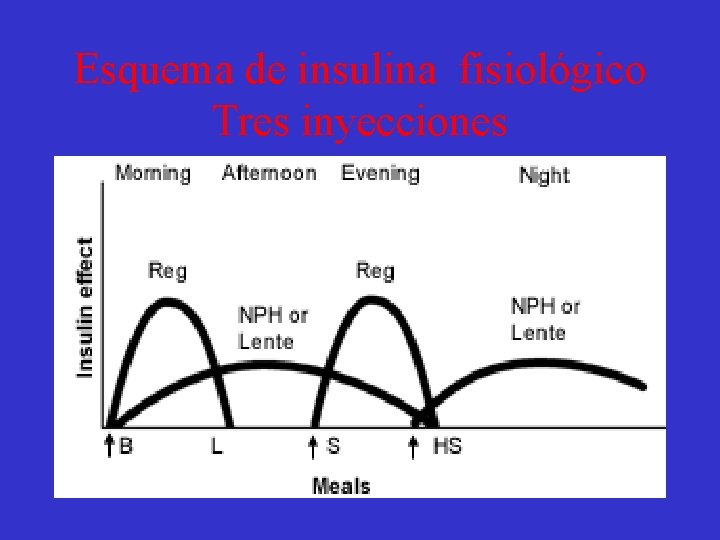 Esquema de insulina fisiológico Tres inyecciones 