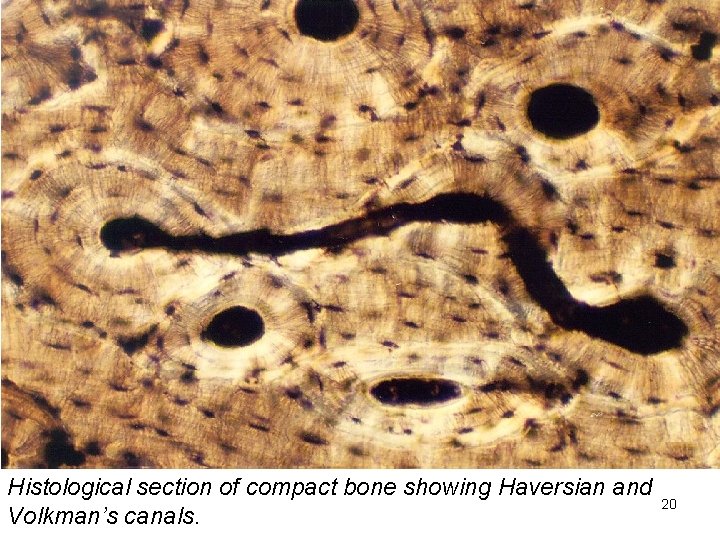 Histological section of compact bone showing Haversian and Volkman’s canals. 20 