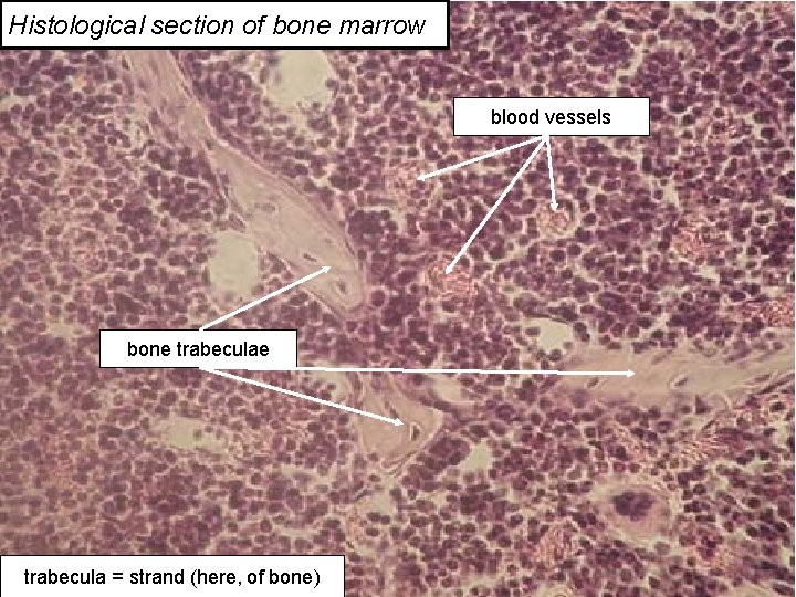 Histological section of bone marrow blood vessels bone trabecula = strand (here, of bone)