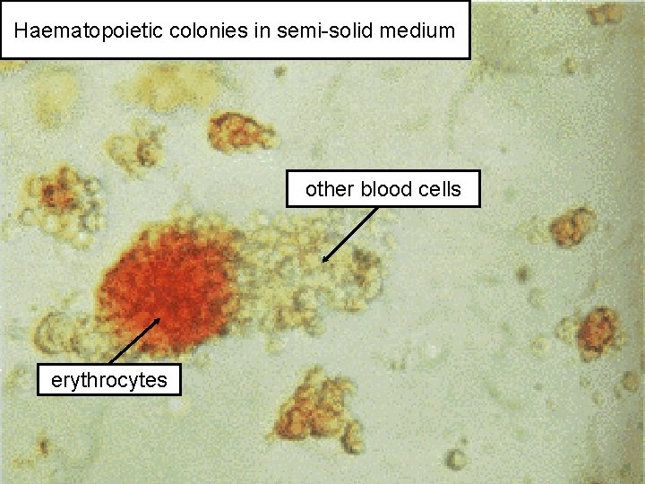 Haematopoietic colonies in semi-solid medium other blood cells erythrocytes 50 