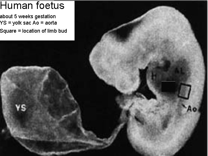 Human foetus about 5 weeks gestation YS = yolk sac Ao = aorta Square
