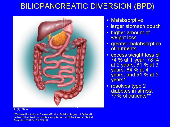 BILIOPANCREATIC DIVERSION (BPD) • Malabsorptive • larger stomach pouch • higher amount of weight