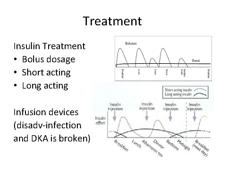 Treatment Insulin Treatment • Bolus dosage • Short acting • Long acting Infusion devices