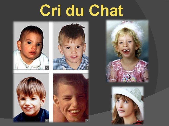 Cri du Chat 