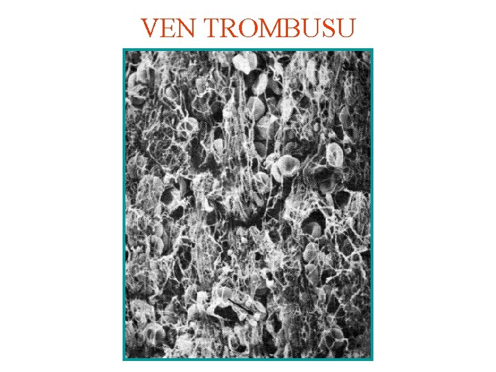 VEN TROMBUSU 