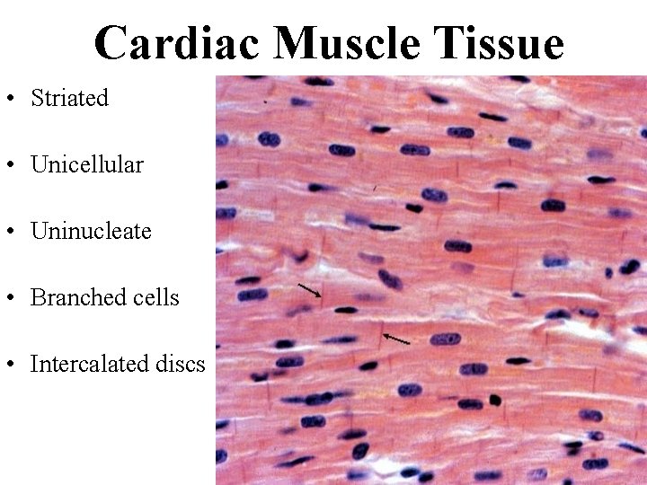 Cardiac Muscle Tissue • Striated • Unicellular • Uninucleate • Branched cells • Intercalated