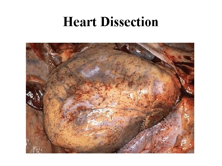 Heart Dissection 