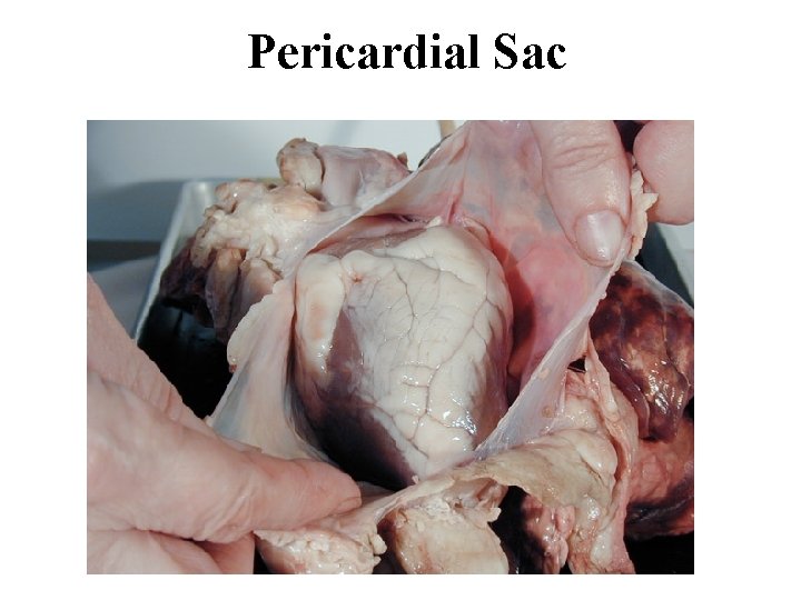 Pericardial Sac 