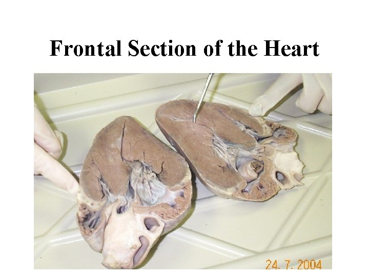 Frontal Section of the Heart 