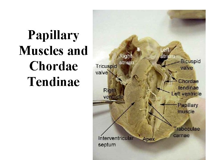 Papillary Muscles and Chordae Tendinae 