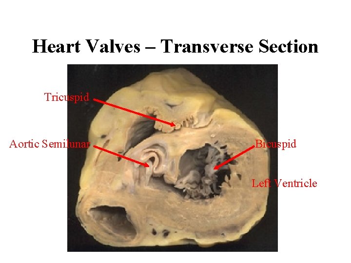 Heart Valves – Transverse Section Tricuspid Aortic Semilunar Bicuspid Left Ventricle 