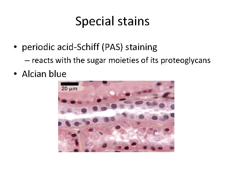 Special stains • periodic acid-Schiff (PAS) staining – reacts with the sugar moieties of Special stains • periodic acid-Schiff (PAS) staining – reacts with the sugar moieties of