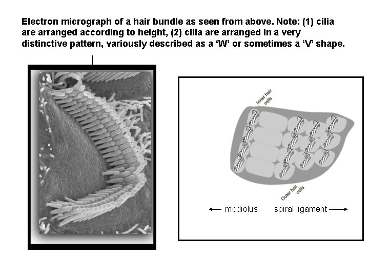 Electron micrograph of a hair bundle as seen from above. Note: (1) cilia are