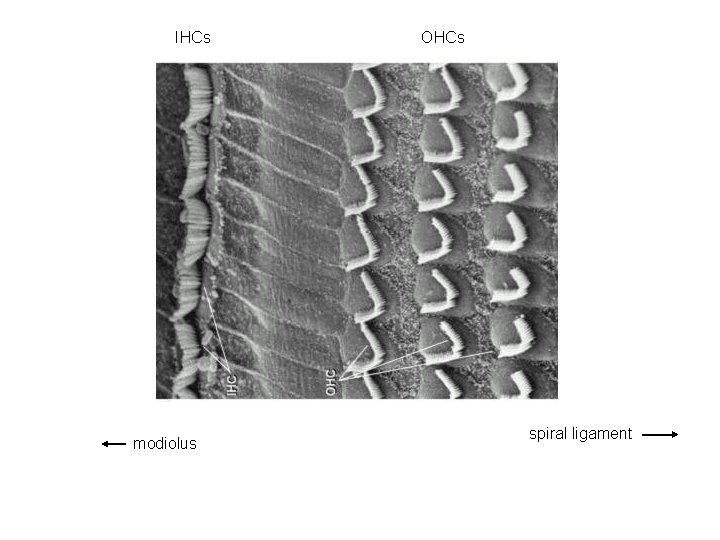 IHCs modiolus OHCs spiral ligament 