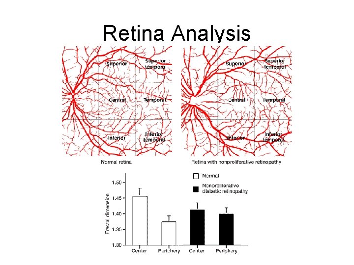 Retina Analysis 