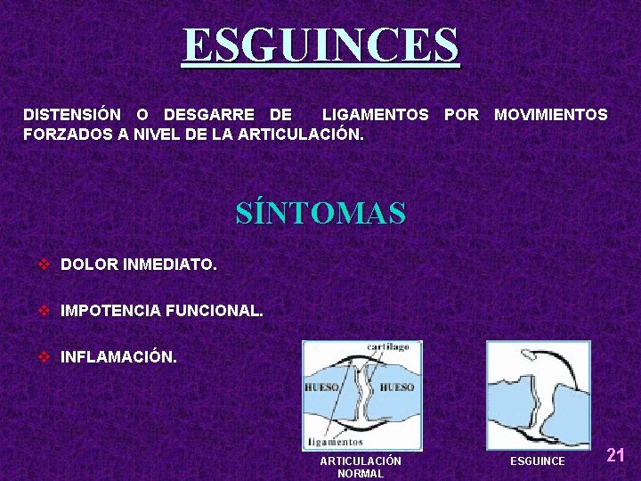 ESGUINCES DISTENSIÓN O DESGARRE DE LIGAMENTOS POR MOVIMIENTOS FORZADOS A NIVEL DE LA ARTICULACIÓN.