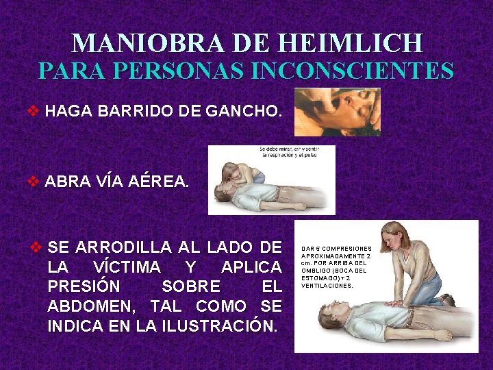 MANIOBRA DE HEIMLICH PARA PERSONAS INCONSCIENTES v HAGA BARRIDO DE GANCHO. v ABRA VÍA