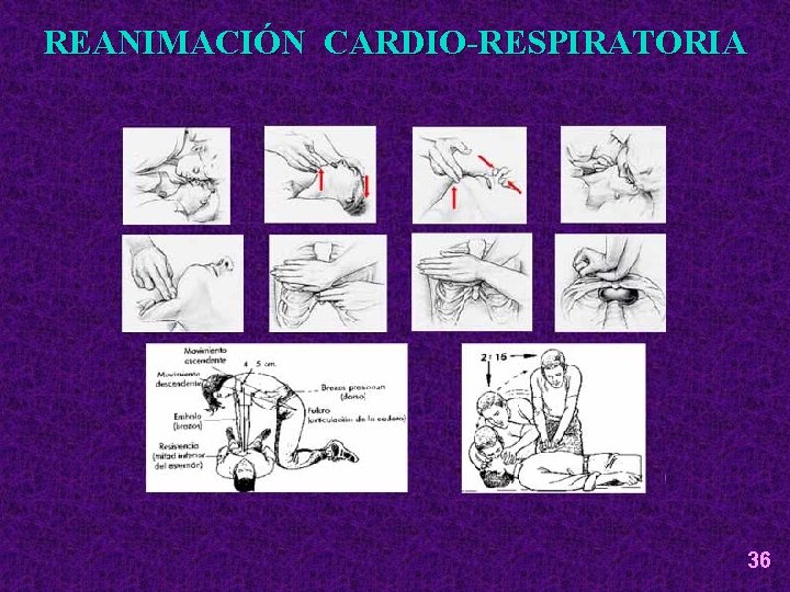 REANIMACIÓN CARDIO-RESPIRATORIA 36 