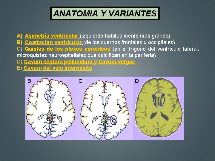 ANATOMIA Y VARIANTES A) Asimetría ventricular (izquierdo habitualmente más grande) B) Coartación ventricular (de