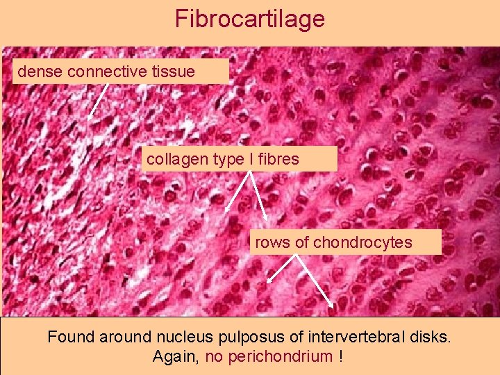 Fibrocartilage dense connective tissue collagen type I fibres rows of chondrocytes Found around nucleus
