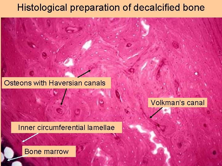 Histological preparation of decalcified bone Osteons with Haversian canals Volkman’s canal Inner circumferential lamellae