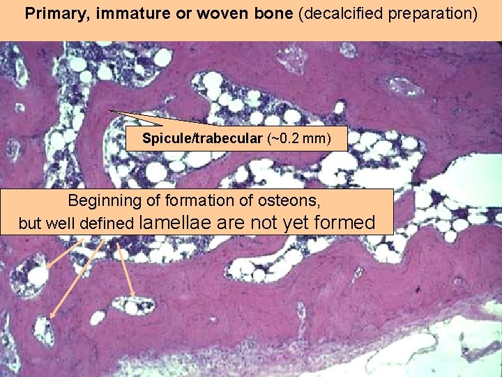 Primary, immature or woven bone (decalcified preparation) Spicule/trabecular (~0. 2 mm) Beginning of formation