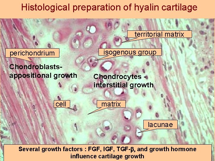 Histological preparation of hyalin cartilage territorial matrix isogenous group perichondrium Chondroblastsappositional growth cell Chondrocytes