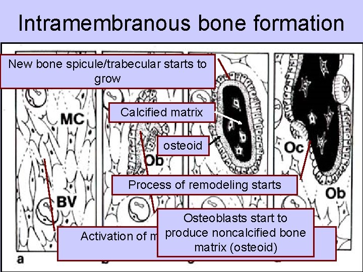 Intramembranous bone formation New bone spicule/trabecular starts to grow Calcified matrix osteoid Process of