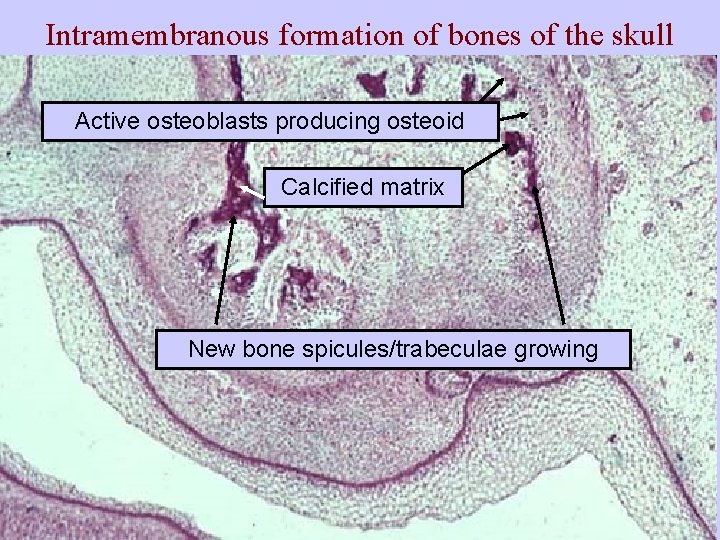 Intramembranous formation of bones of the skull Active osteoblasts producing osteoid Calcified matrix New