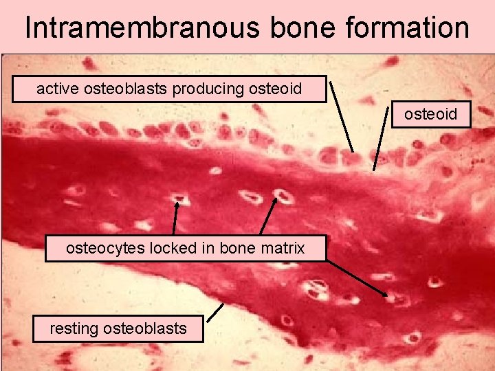 Intramembranous bone formation active osteoblasts producing osteoid osteocytes locked in bone matrix resting osteoblasts