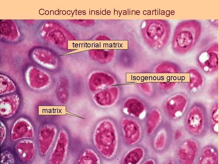 Condrocytes inside hyaline cartilage territorial matrix Isogenous group matrix 