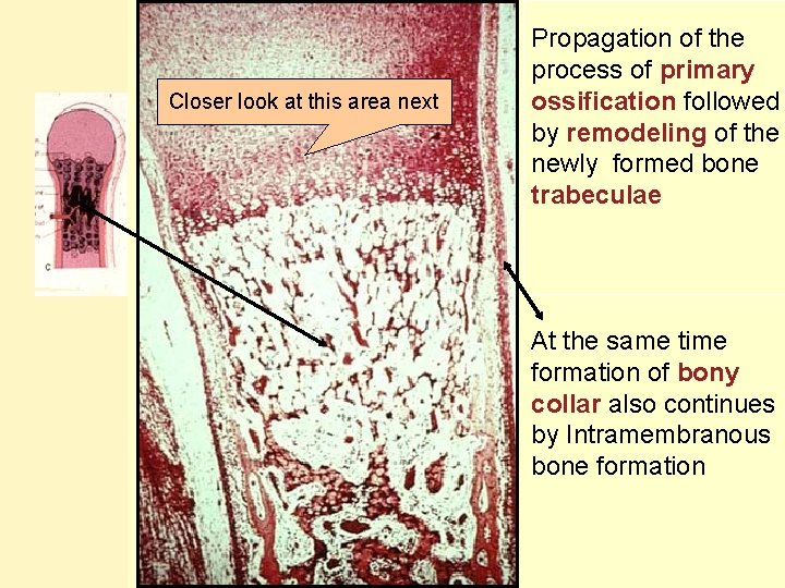 Closer look at this area next Propagation of the process of primary ossification followed