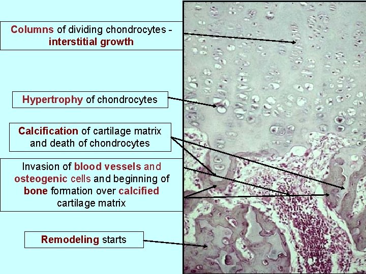 Columns of dividing chondrocytes interstitial growth Hypertrophy of chondrocytes Calcification of cartilage matrix and