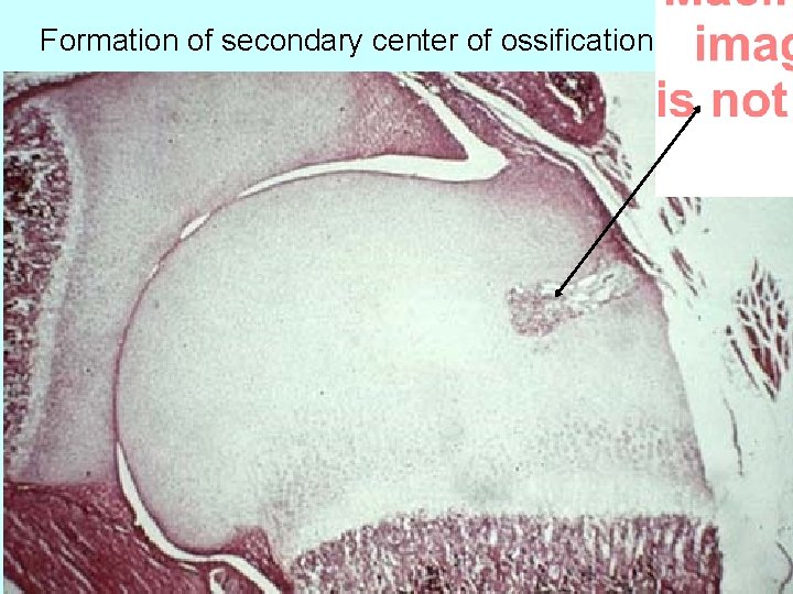 Formation of secondary center of ossification 