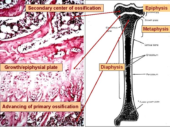 Secondary center of ossification Epiphysis Metaphysis Growth/epiphysial plate Advancing of primary ossification Diaphysis 